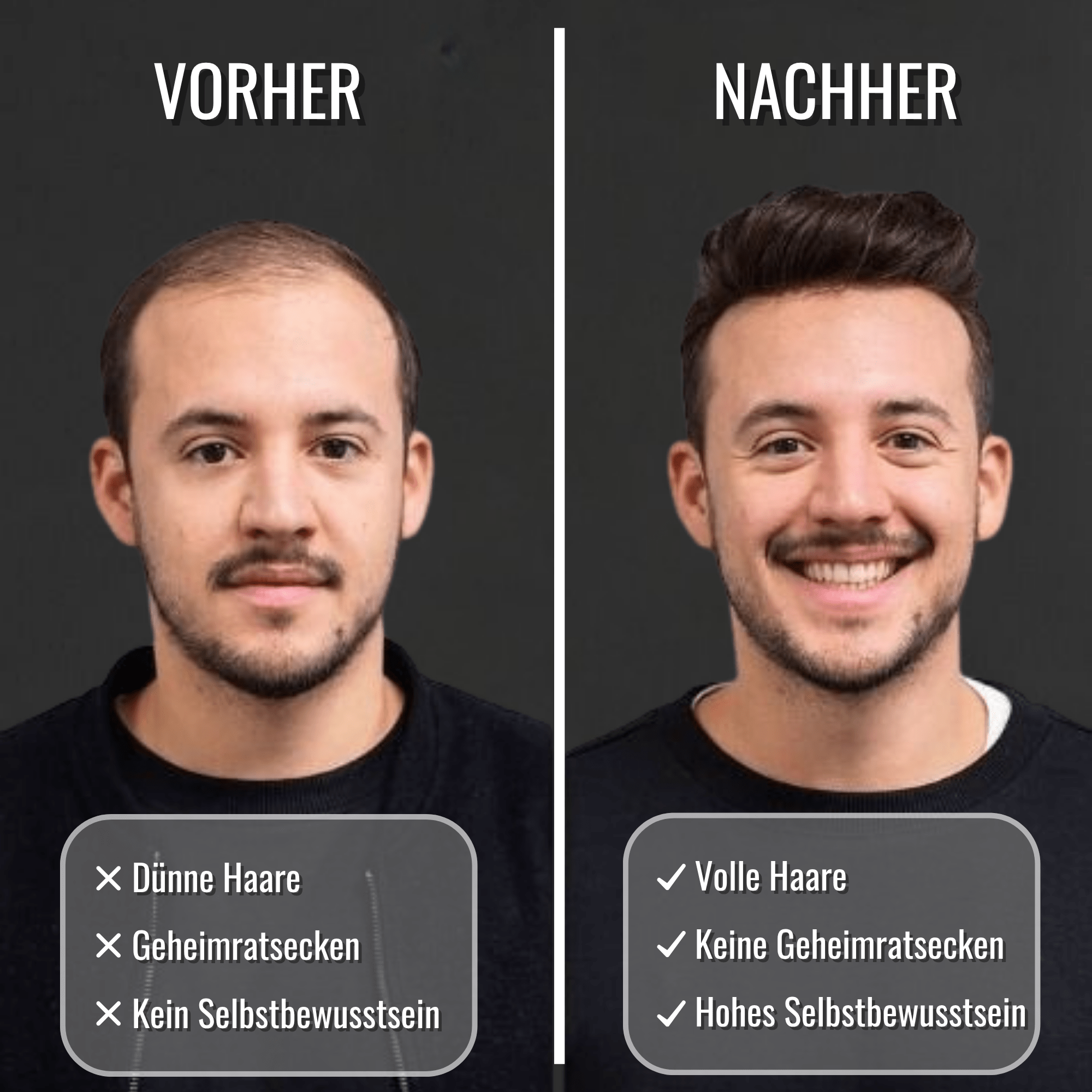 Teluni™ BabboSow Haaröl FÜR MÄNNER - Teluni