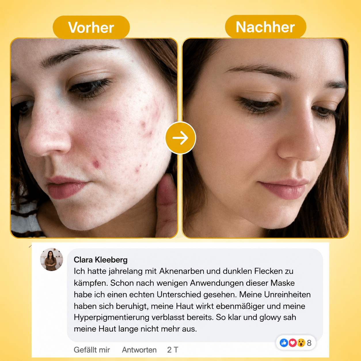 KOJIC ACID KURKUMA NIGHT WRAPPING MASKE - Teluni