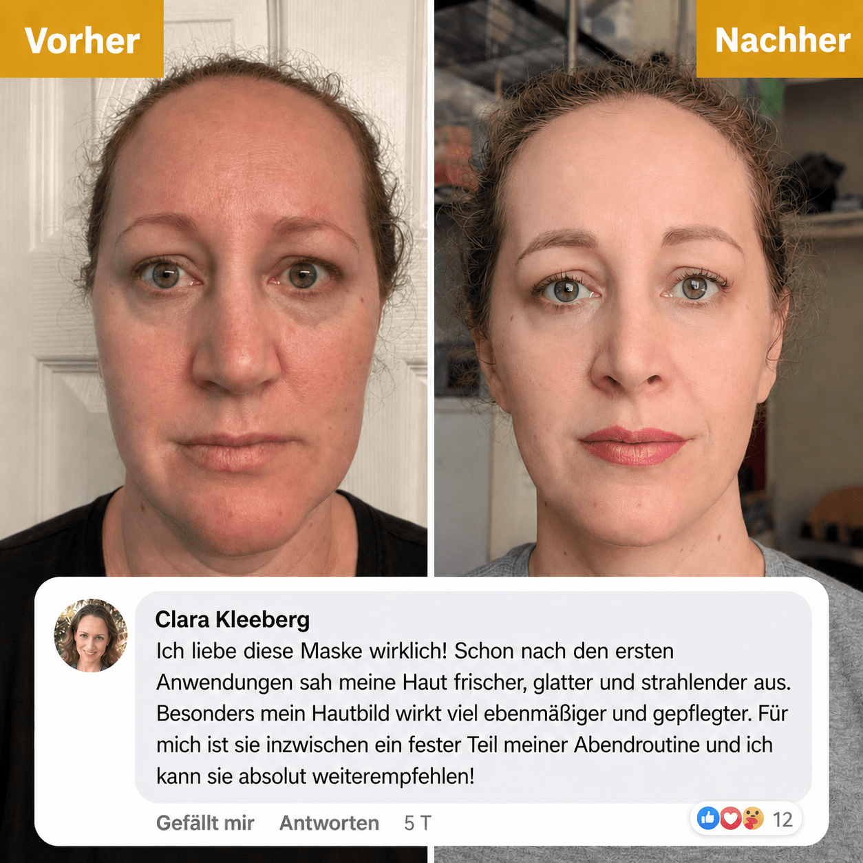 KOJIC ACID KURKUMA NIGHT WRAPPING MASKE - Teluni